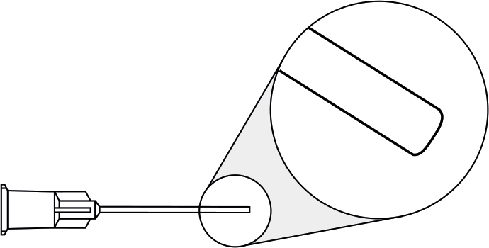 Vorderkammerkanülen, gerade