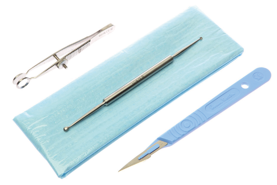 Chalazionsets Chalazionsets