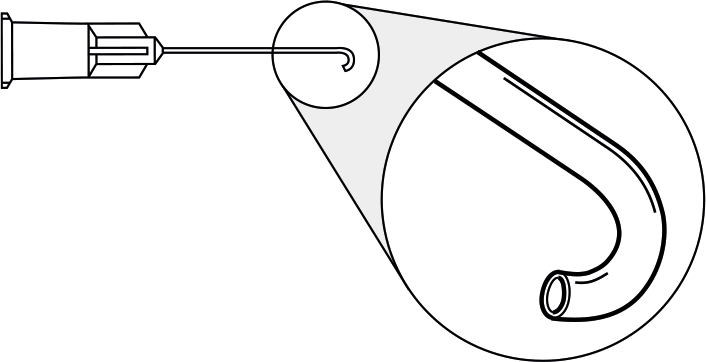 Kanülen zur Kortexentfernung/J-förmig